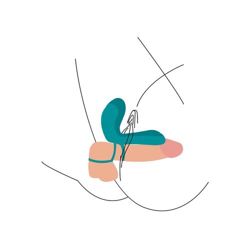 ANILLO DOBLE ESTIMULACIÓN - Imagen 2